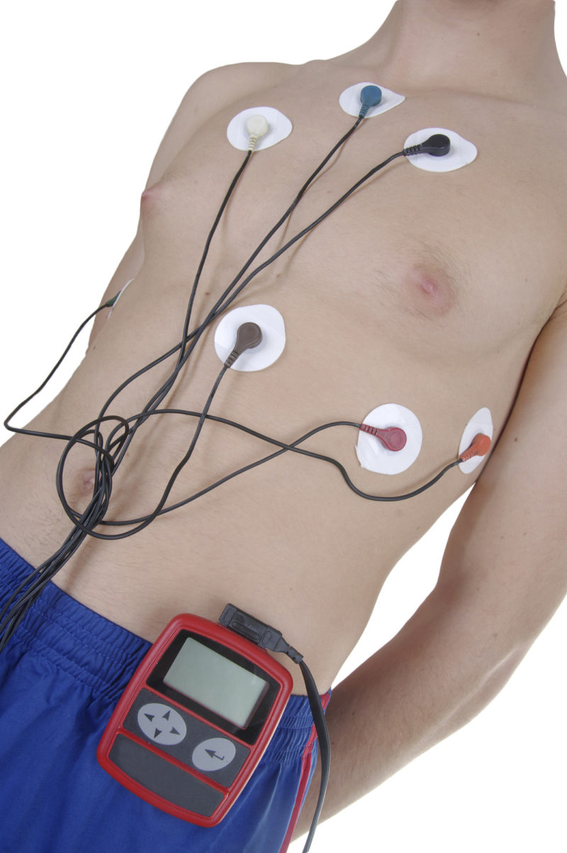 24 Hour Holter Monitor Cardiac Diagnostic Services 0403